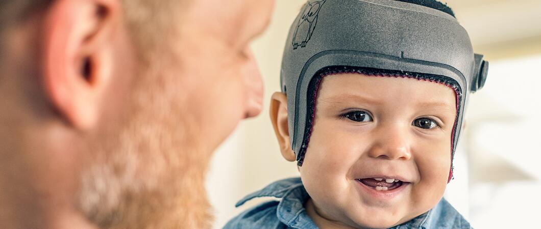 Babys schlafen am sichersten in der Rückenlage. Dadurch kann sich die noch weiche Schädeldecke verändern und der Kopf sich asymmetrisch verformen. Diese ungewollte Deformation des Kinderschädels kann korrigiert werden. Die Experten von STOLLE beraten