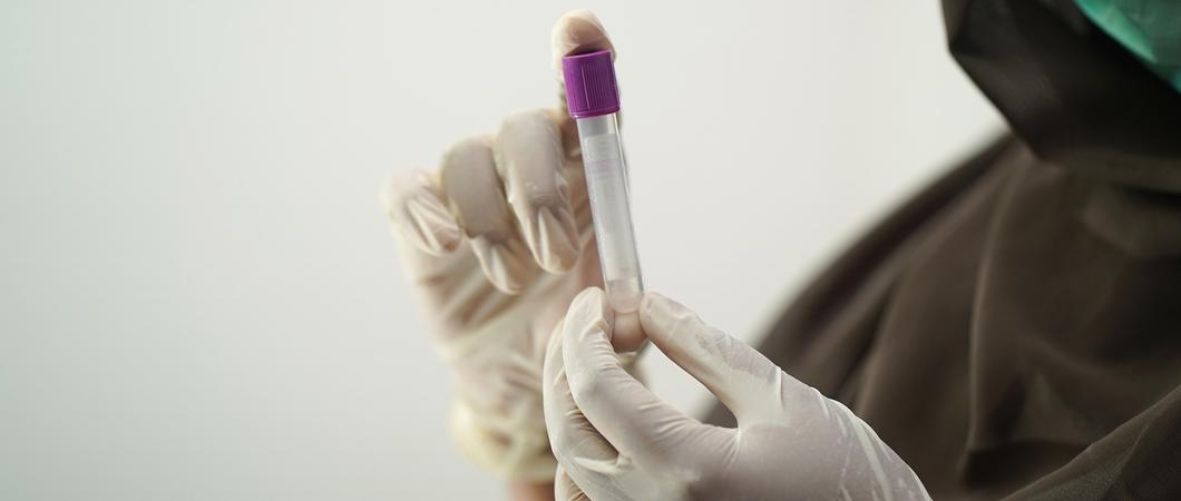 Mit dem Corona-Virus Infizierte erhalten ab 1. April 2022 vom Gesundheitsamt Schwerin keine gesonderten Isolationsbescheide mehr.